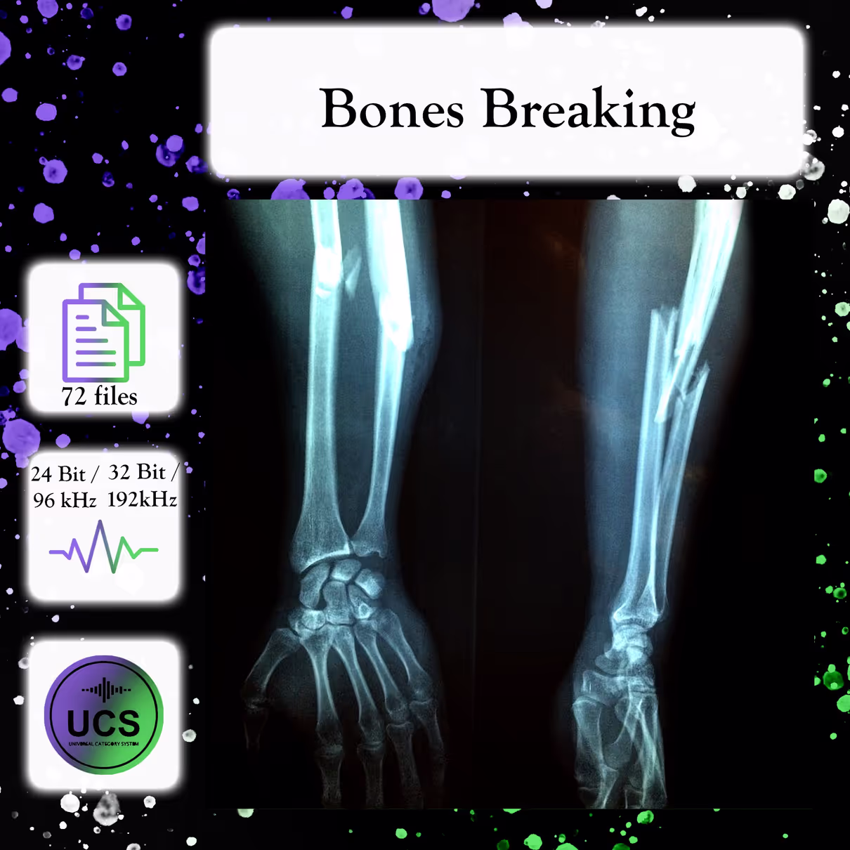 Bone Cracking sound effects library by Celine Woodburn